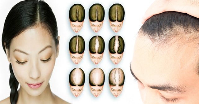 How to Minimize and Prevent Hair Loss In Natural Way?
